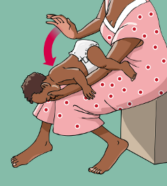 How to give back blows to an infant