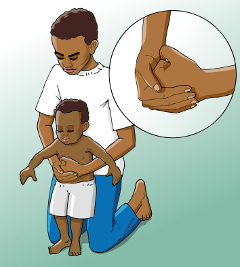 How to give abdominal thrusts to a young child